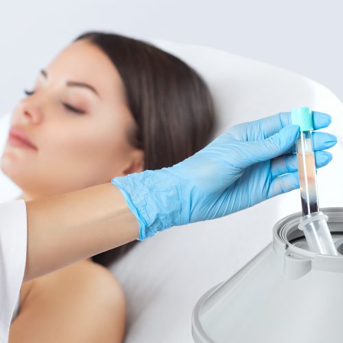 Collagen Induction Therapy | Synergy Wellness MediSpa in Red Bank, NJ