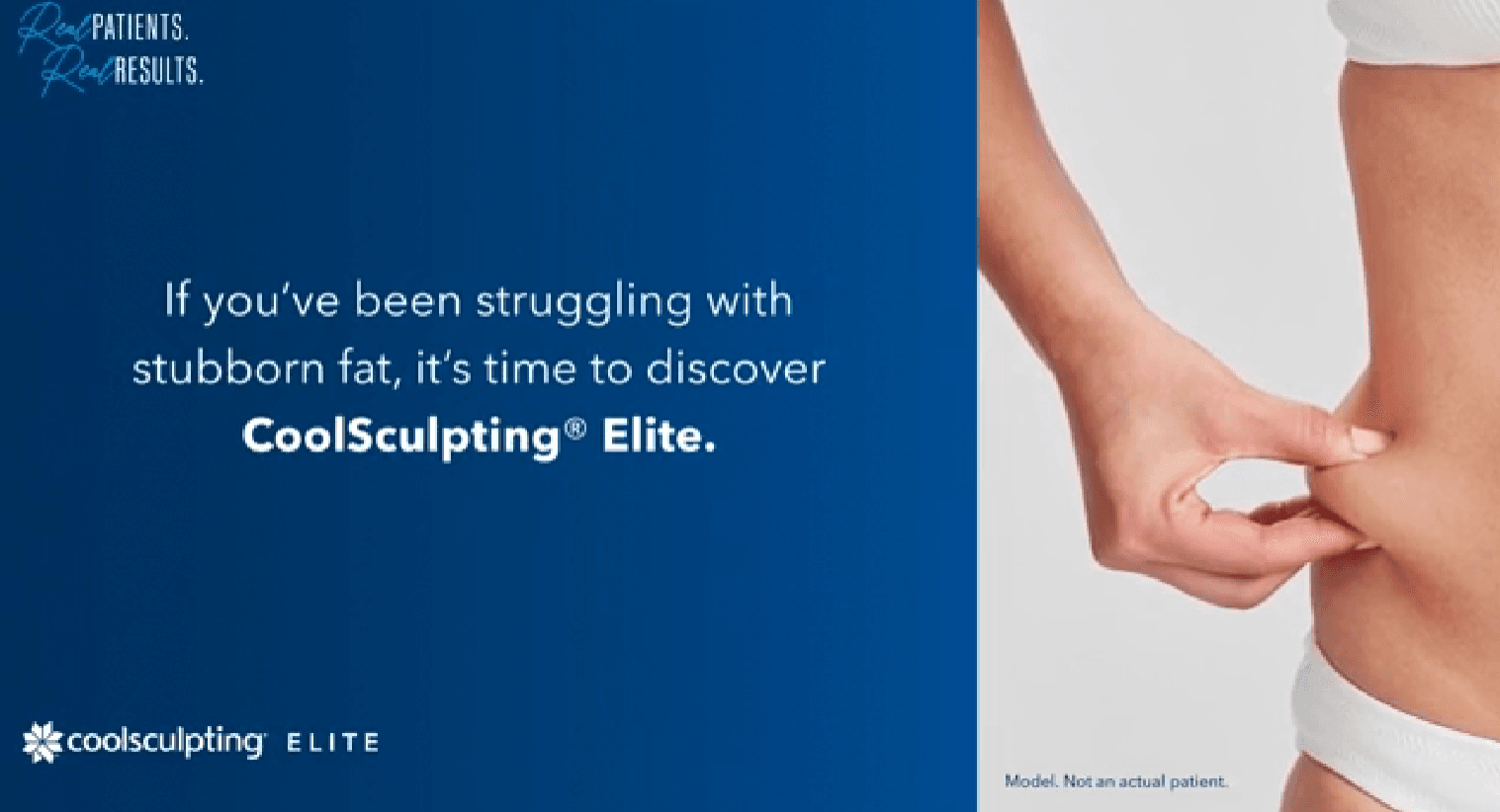 Coolsculpting Elite - Synergy Wellness and Medspa