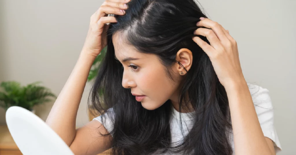 Woman examining thinning hairline in mirror, showing early signs of hair loss and need for hair restoration treatment in Red Bank, NJ.