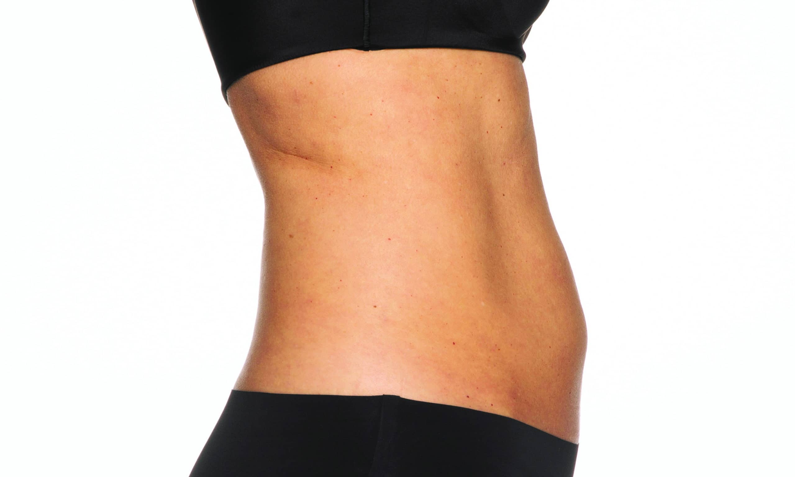 a close up of a woman's stomach - Abdomen AFTER | Synergy Wellness and Medispa | Oceanport, NJ