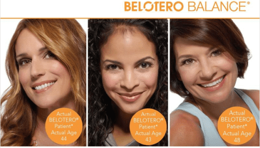 a collage of women with different facial features - Belotero Balance | Synergy Wellness MediSpa in Oceanport, NJ