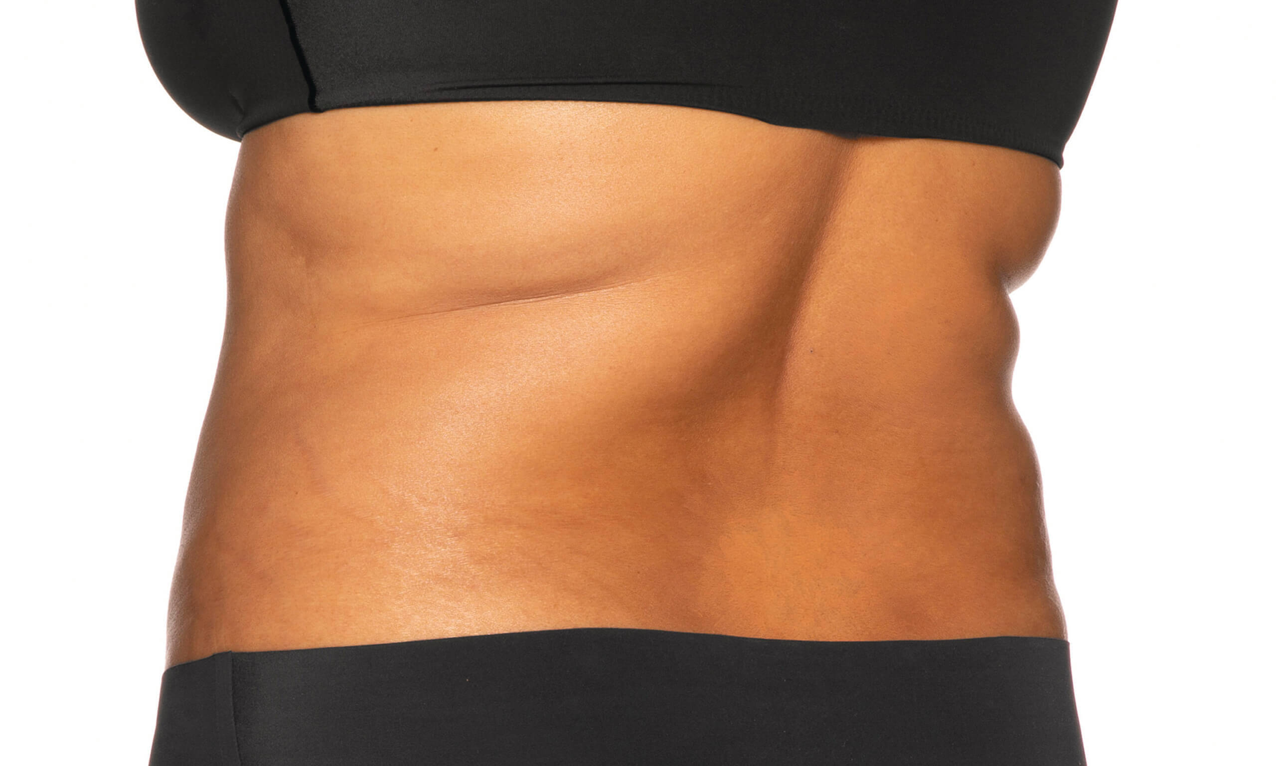 a close up of a woman's stomach in Coolsculpting Elite After Treatment Bra Area & Flanks | Synergy Wellness MediSpa in Oceanport, NJ