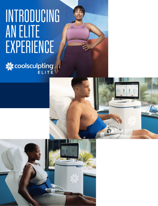 a collage of people in different poses - Coolsculpting® Elite, reshape your figure with Cryolipolysis | Synergy Wellness MediSpa