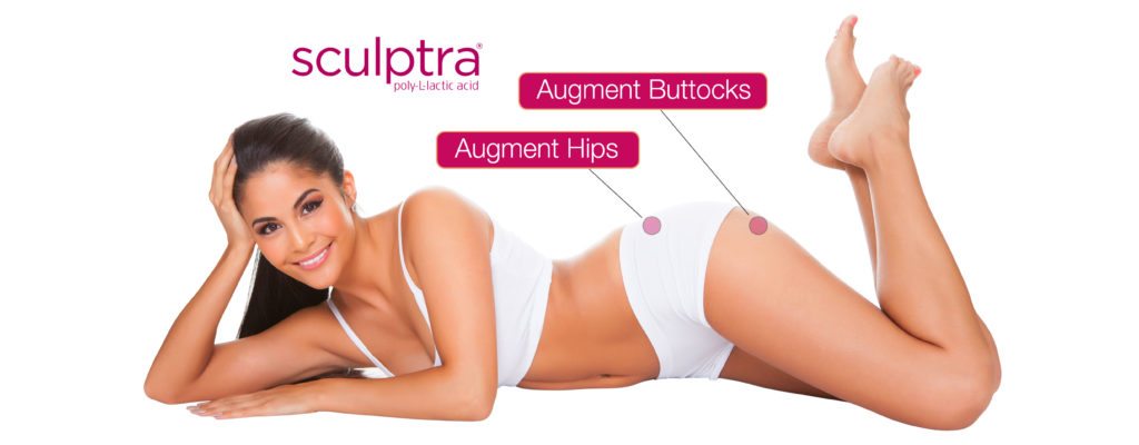 a woman lying on the floor - Sculptra Result Augmented Hips & Buttocks by Synergy Wellness MediSpa
