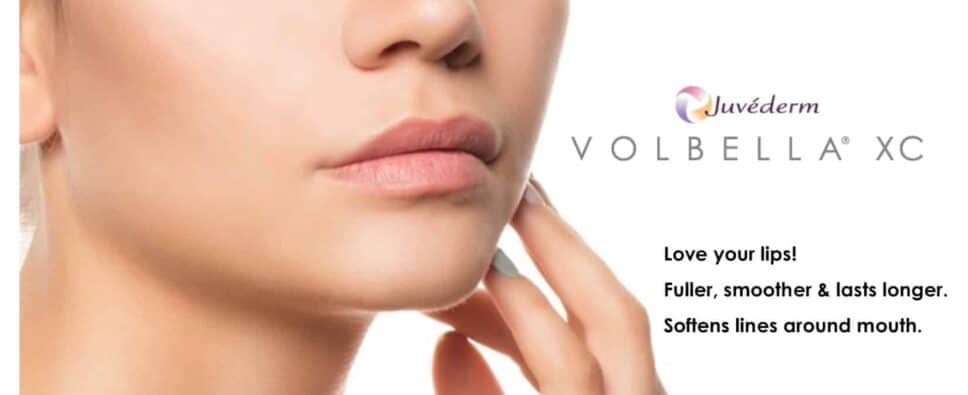 a close up of a woman's lips - Volbella synergy | Synergy Wellness MediSpa in Oceanport, NJ