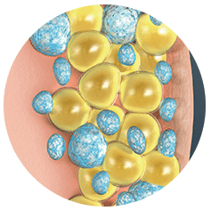 a close-up of yellow and blue spheres - CRYOBOD Fat Freezing Treatment-Cryotherapy | Synergy Wellness MediSpa in Oceanport, NJ