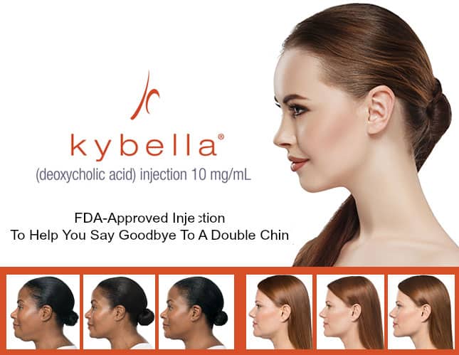 a collage of women's faces - Kybella | Synergy Wellness MediSpa in Oceanport, NJ