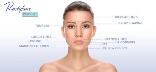 a woman with lines on her face - Restylane Defyne Injectables | Synergy Wellness MediSpa in Oceanport, NJ