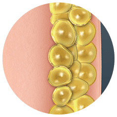 close-up of yellow bubbles - CRYOBOD Fat Freezing Treatment-Cryotherapy reducing inches, banishing cellulite, toning and firming the skin | Synergy Wellness MediSpa in Oceanport, NJ